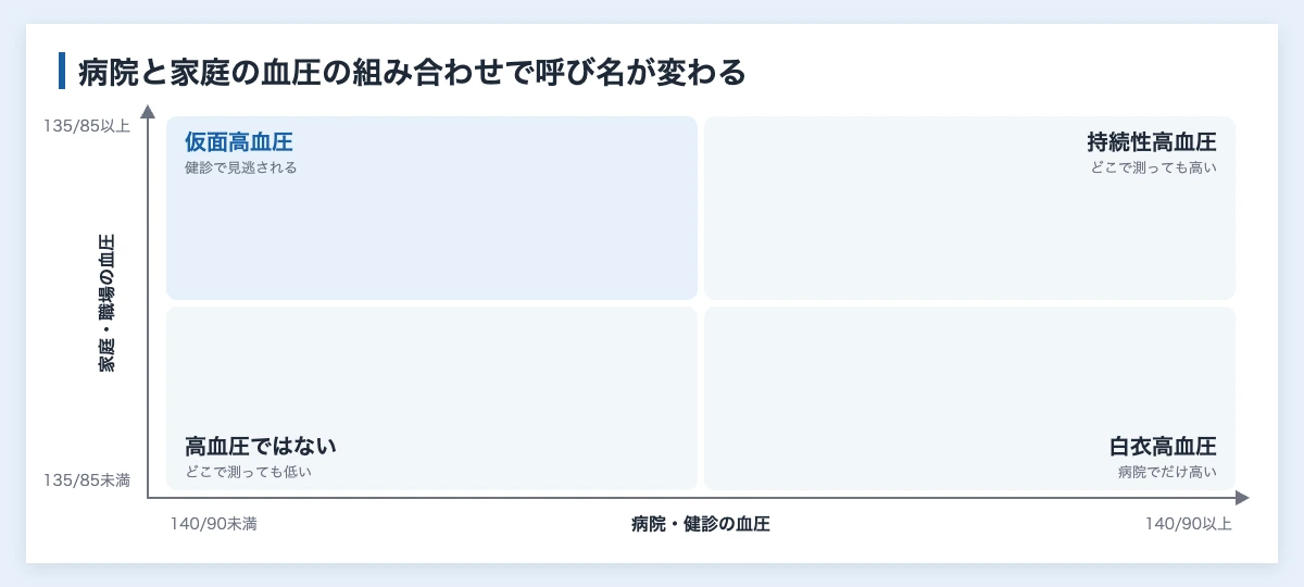 血圧を測るタイミングと方法|企業の健康経営とスポーツ施策で使う 11 血圧を測る場所による違いの図解。病院と家庭の血圧の組み合わせで白衣高血圧・仮面高血圧・持続性高血圧を分ける